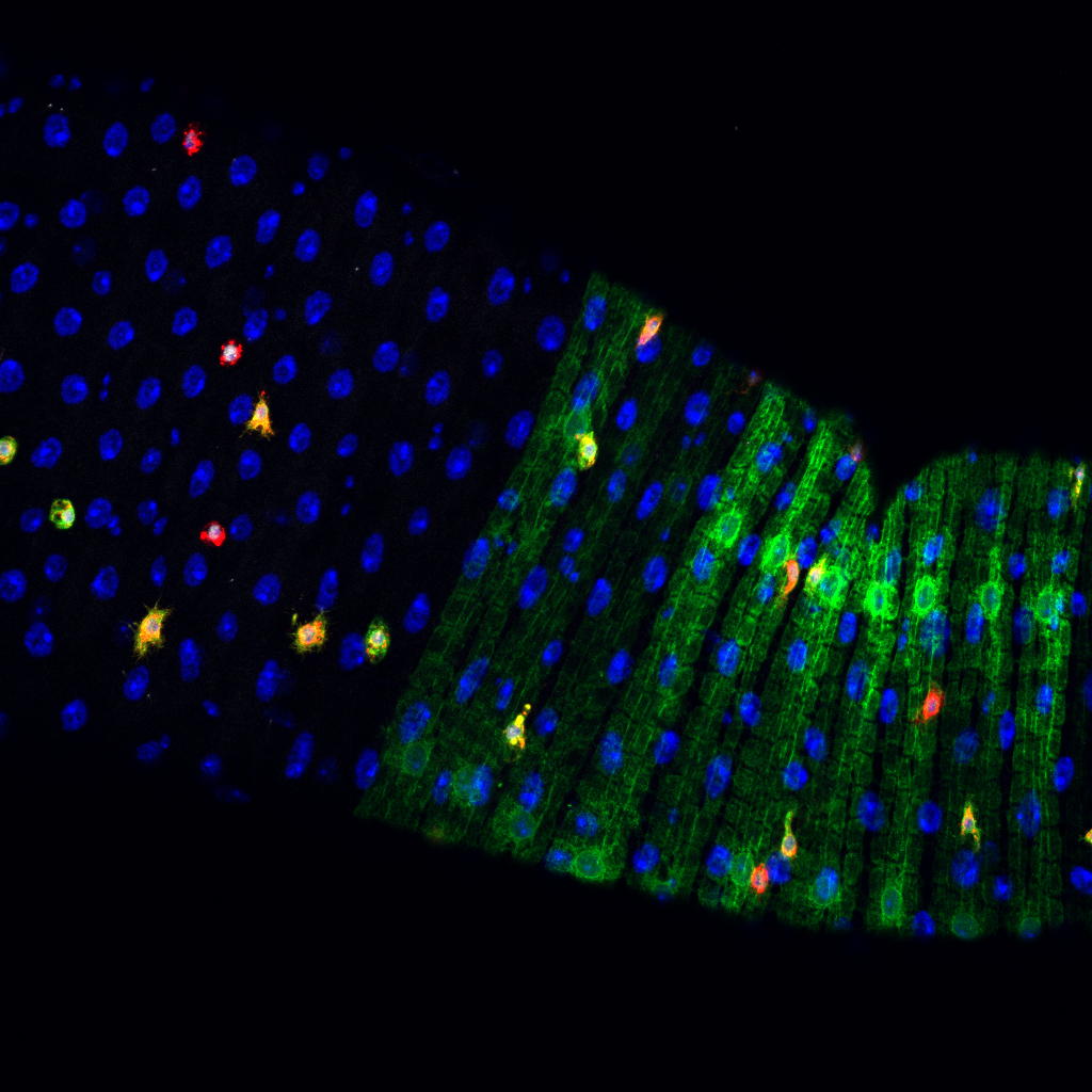 2020-03-06T16:47:23      

      

         Camera Name: Nikon A1plus

Numerical Aperture: 1.3

Refractive Index: 1.515

Number of Picture Planes: 4

Plane #1:

 Name: DAPI

 Component Count: 1

 Modality: Widefield Fluorescence, Laser Scan Confocal

 Camera Settings:                 

  {Scanner Selection}: Galvano

  {Detector Selection}: DU4

  {Optical Path Mode}: Manual

  {First Dichroic Mirror}: 405/488/561/640

  {First Filter Cube}: 450/50

  {Second Filter Cube}: 525/50

  {Third Filter Cube}: 595/50

  CH1	{Laser Wavelength}: 405.0	{Laser Power}: 5.5

  	{PMT HV}: 82	{PMT Offset}: -5

  CH2	{Laser Wavelength